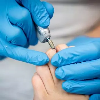 alt "Medizinische Fusspflege - Fußpflegepraxis Deggendorf eingewachsene Fußnägel"